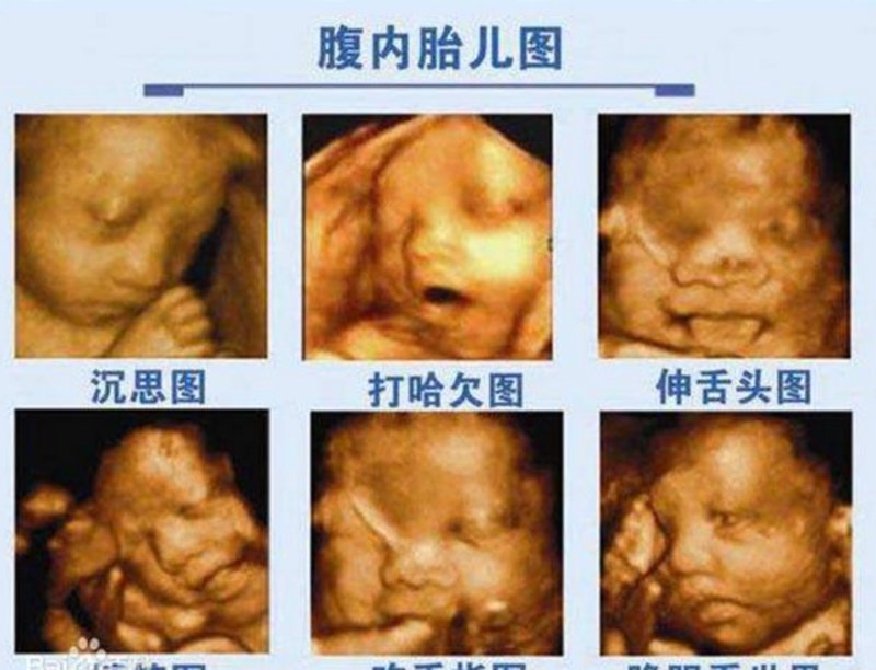 关注母婴健康:聚焦杭州仁德妇产医院的发展动态